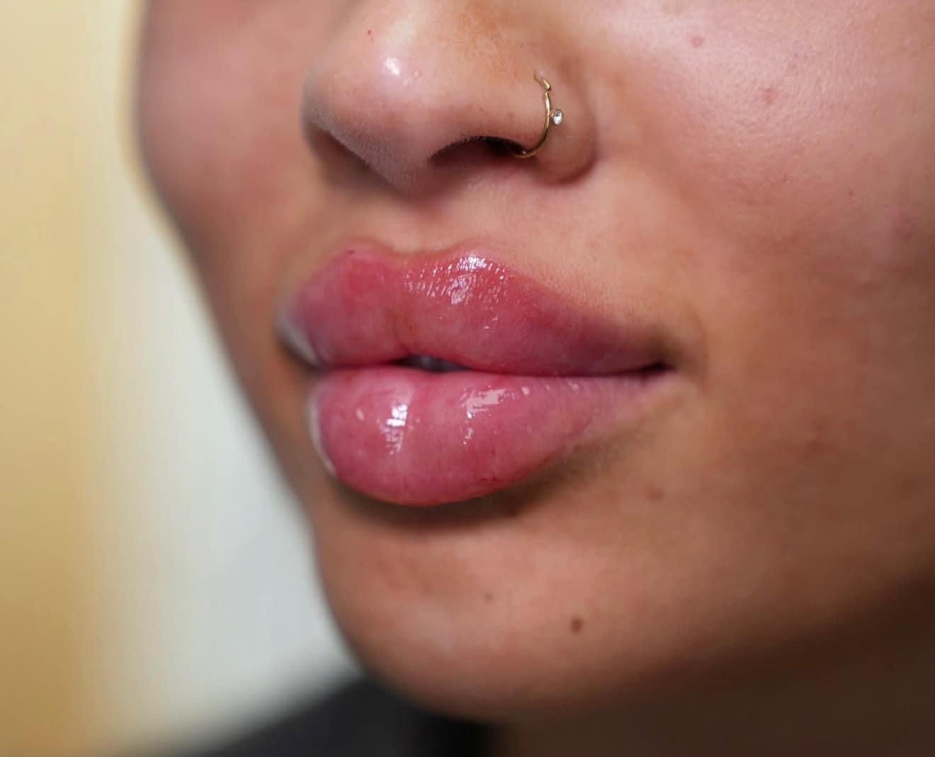 Russian lip enhancement by Face by Demi